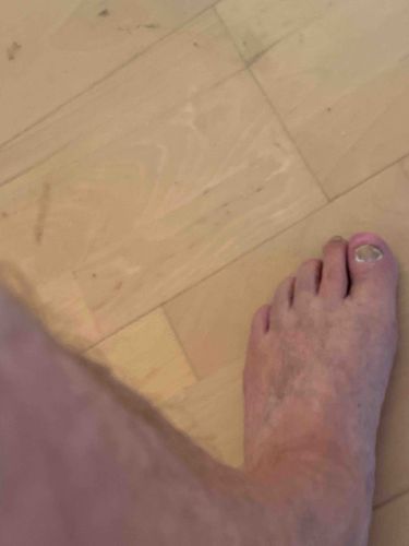 Human Foot with Flooring Background