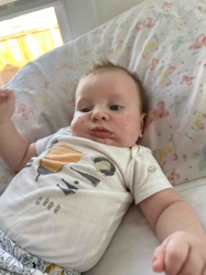 Infant with Possible Skin Rash